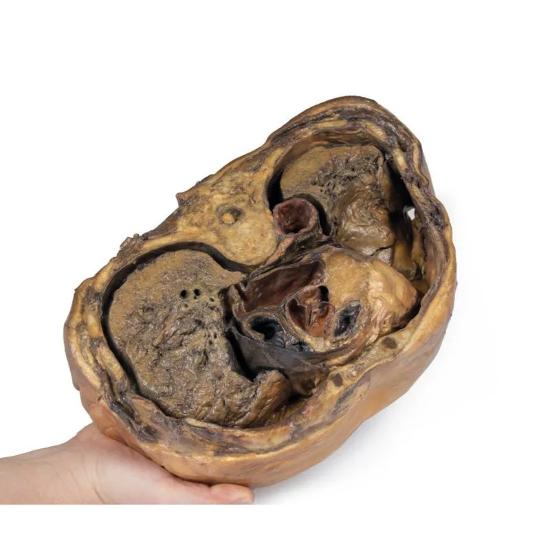 3D Printed Thoracic Cross Section at T6