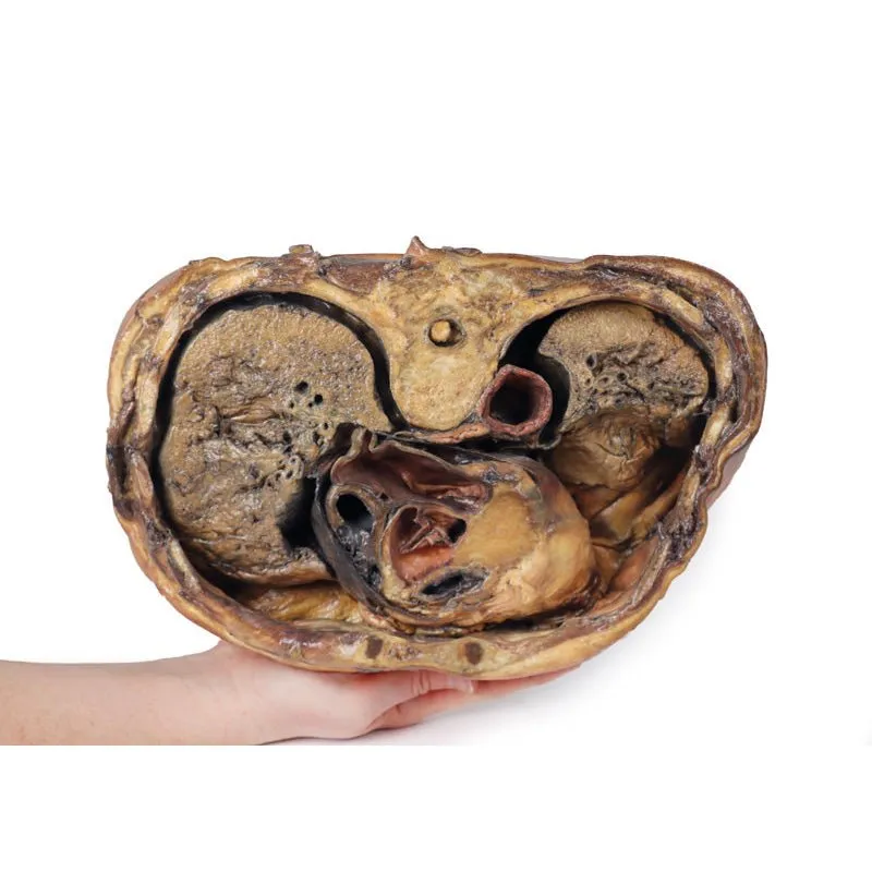 3D Printed Thoracic Cross Section at T6